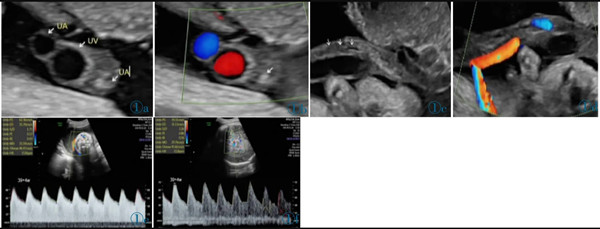 臨床醫(yī)學(xué)論文5000字