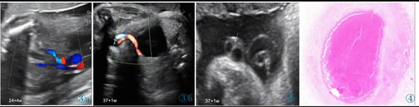 臨床醫(yī)學(xué)論文5000字